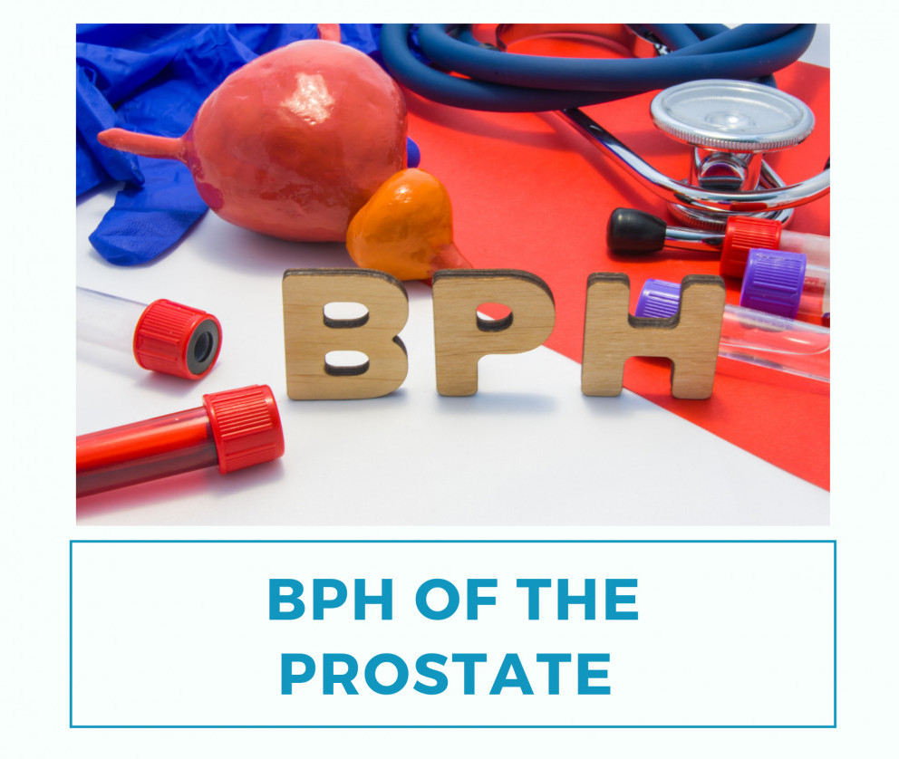 BPH of the prostate