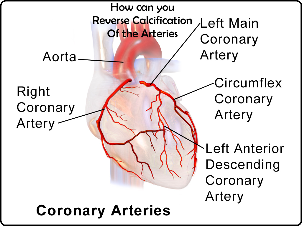 How can you reverse calcification of the arteries 