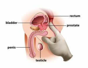 Prostate massager image