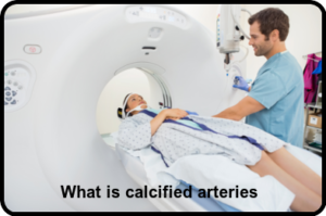 What is calcified arteries calcium score xray