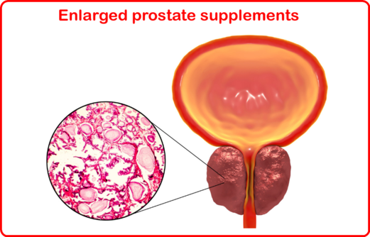 Enlarged prostate supplements image 