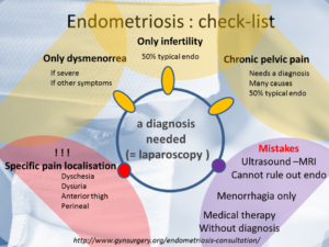 Best endometriosis natural treatment 