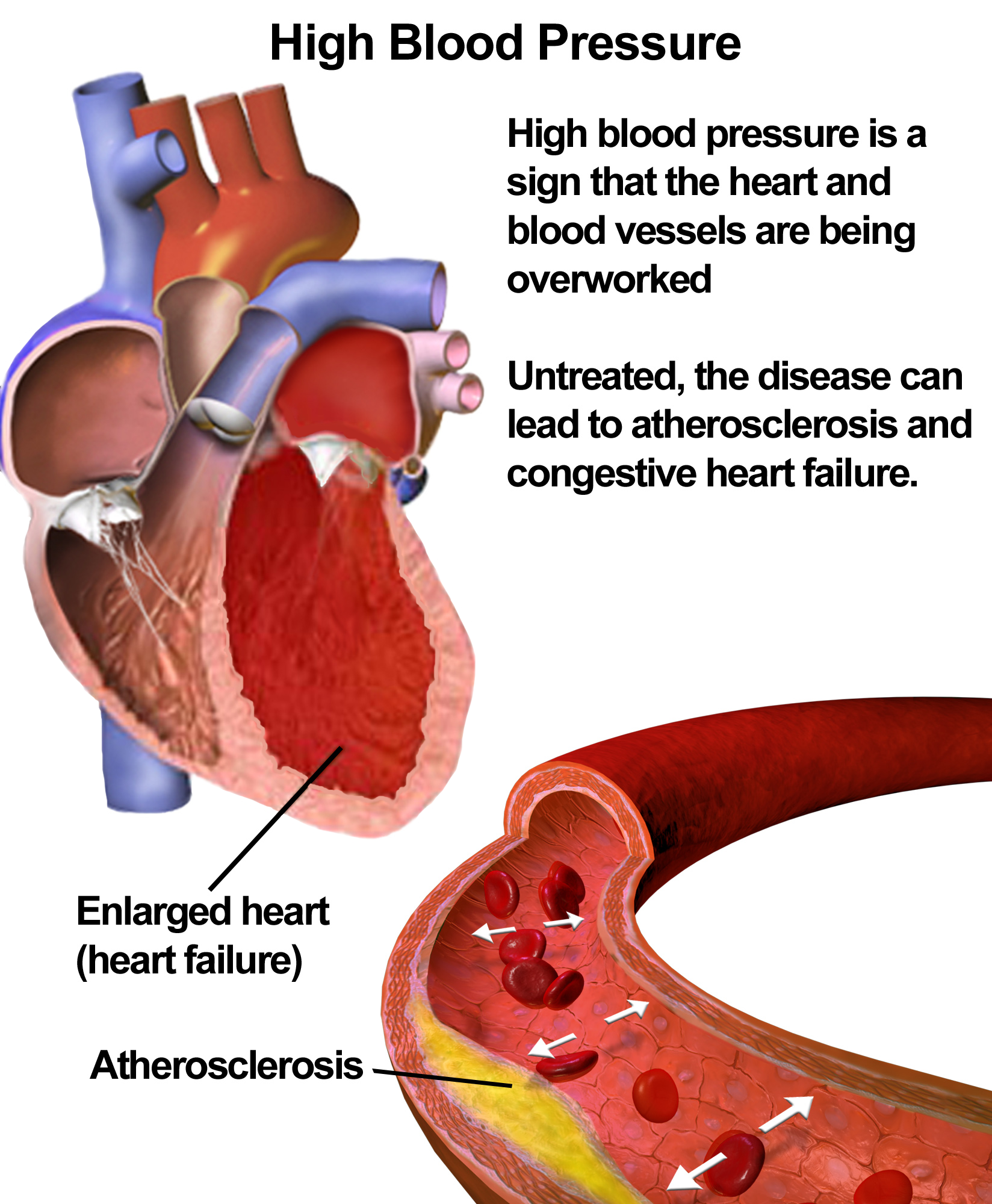 supplements-for-blood-pressure-that-work-synergy-heart-health