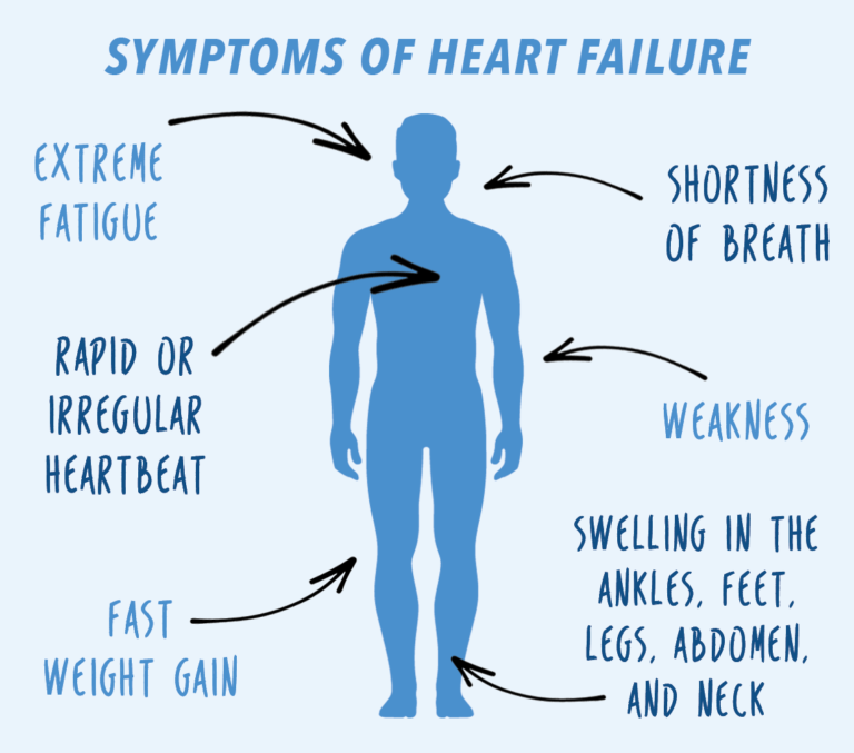 Early symptoms of heart disease * Synergy Heart & Health