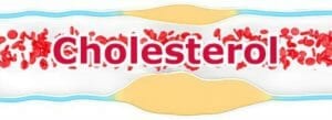 cholesterol deposits