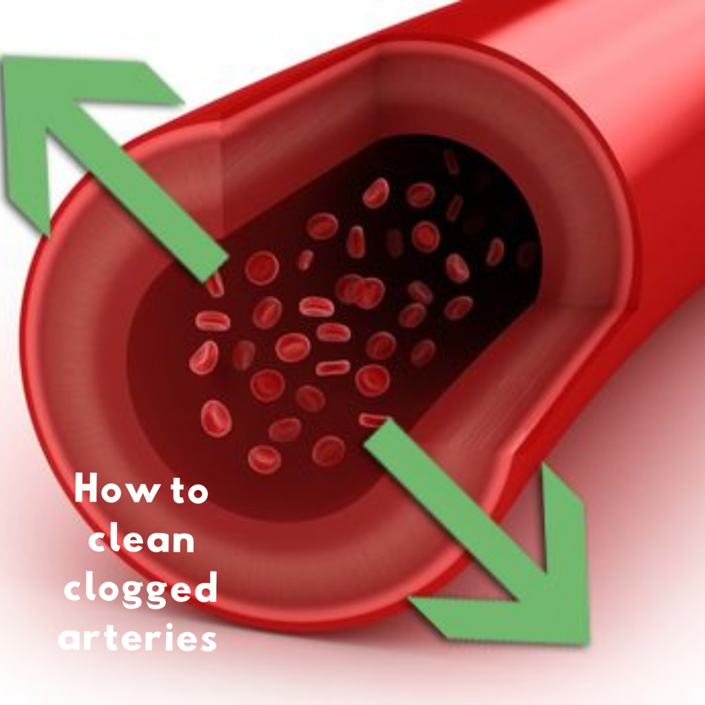 How to clean clogged arteries image