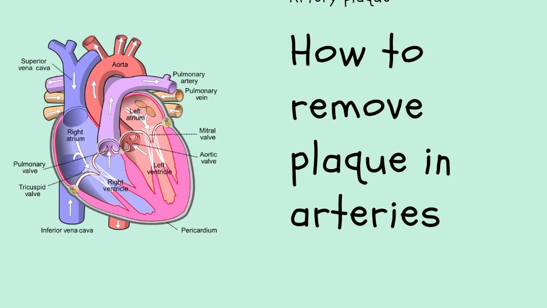 How to remove plaque in arteries